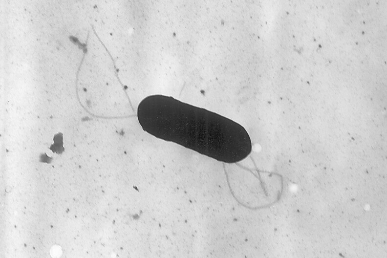 An electron microscope image of Listeria monocytogenes bacterium. Health officials have announced a recall of liverwurst and deli meat products in connection with a national listeria outbreak.