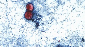 In the past, people have been infected with cycloporiasis by consuming fruits or vegetables that were exposed to contaminated irrigation water.
