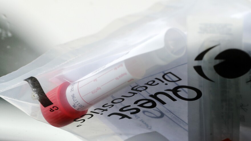 A testing kit sits on the windshield of a car as it passes through a drive-through COVID-19 testing site set up in St. Charles, Mo.