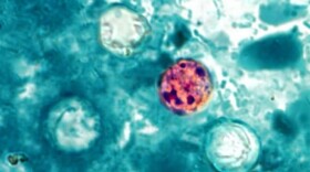 A view of a red blob with dark specs under a microscope lens, surrounded by various shades of blue and white.