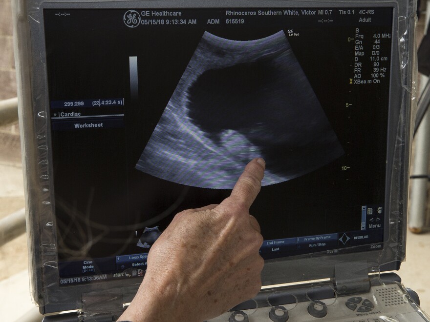 An ultrasound of Victoria shows a 2-month-old embryo.