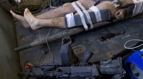 A NATO soldier wounded by an IED explosion lies in a helicopter during an emergency airlift in Kandahar province, southern Afghanistan on October 12, 2010.  Bombs, not bullets, are the main threat to soldiers in Iraq and Afghanistan. (Getty Images)