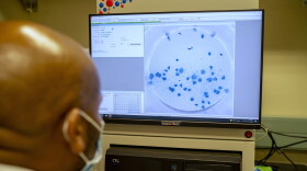 A researcher at the Africa Health Research Institute in Durban, South Africa, works on the omicron variant of the COVID-19 virus on Dec. 15, 2021. (Jerome Delay/AP)