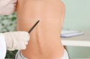 Adolescent idiopathic scoliosis occurs in boys and girls, but progressive cases are far more common in girls.