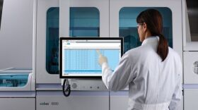 The cobas 6800 can run more than a thousand tests every 24 hours.