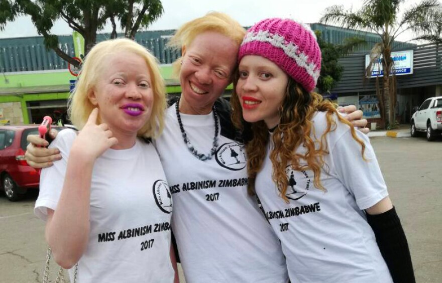 The "Miss Albinism" pageant was rescheduled due to the political uncertainty in Zimbabwe. From left: contestant Cindy Zikwature, Brenda Mudzimu, the founder of the pageant, and contestant Monalisa Manyati.