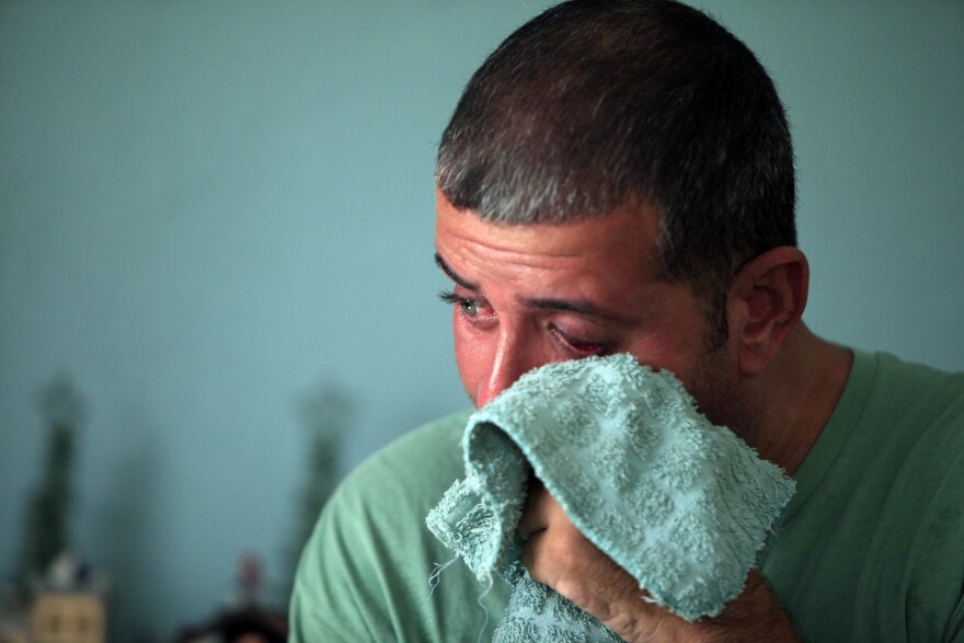 In this Thursday, Nov. 11, 2015 photo, Jose Gonzalez Ortiz, 42, who suffers from Lou Gehrigs disease, uses a towel to wipe away his tears while being interviewed by the Associated Press at his home in Arecibo, Puerto Rico. The 42-year-old former prison guard struggled moving from the porch to inside his modest concrete house, using a walker that his church donated because Puerto Ricos straining public health care system wont pay for a wheelchair, and will soon be picking up the bill for less. (AP Photo/Ricardo Arduengo)