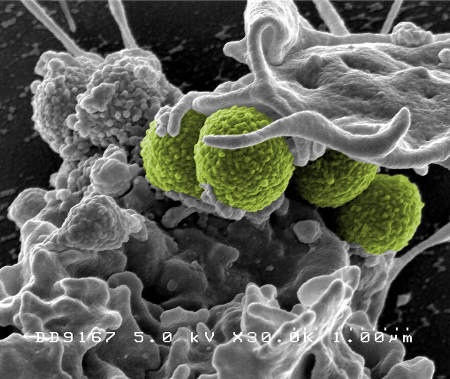 The MRSA252 strain (green bacteria) is a leading cause of hospital-associated infections in the U.S. and the UK.