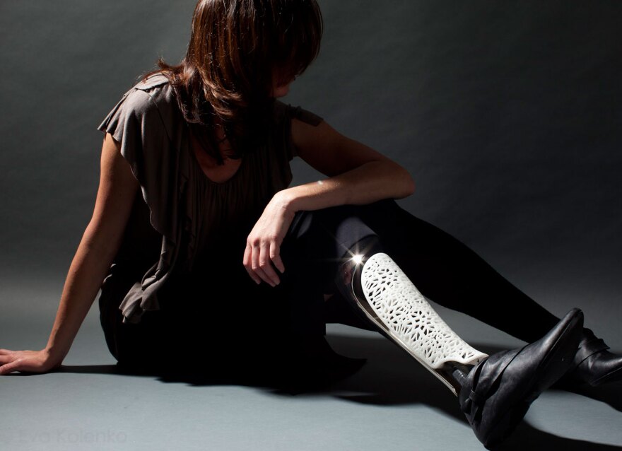 Almost Genius: Women's Prosthetic Limbs as Fashion Accessories