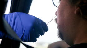 In the last seven days, Indiana has reported more than 20,000 new cases, nearly half of the month’s total. It has also reported more than 70 deaths for the second week in a row.