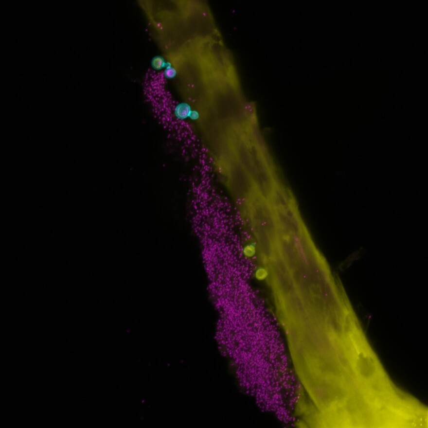 Bacteria (magenta) and fungi (cyan) on a human hair (yellow).