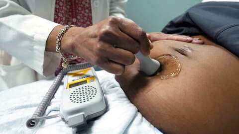 A doctor uses a hand-held Doppler probe on a pregnant woman to measure the heartbeat of the fetus. (Rogelio V. Solis/AP)