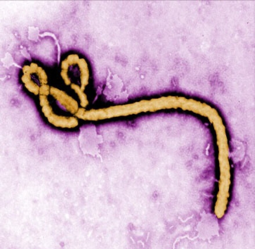 Ebola virus under microscope