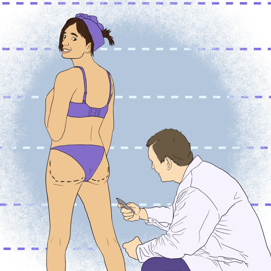 An illustration featuring a feminine person wearing a purple bra, purple underwear and a purple kerchief in their dark brown hair. Their backside is to the camera, and their head is turned to look behind them. There are dotted lines along their buttcheeks. A white man in a white lab coat is kneeling down in front of their body, holding an uncapped marker. The background of the illustration features dotted lines as horizontal stripes. 