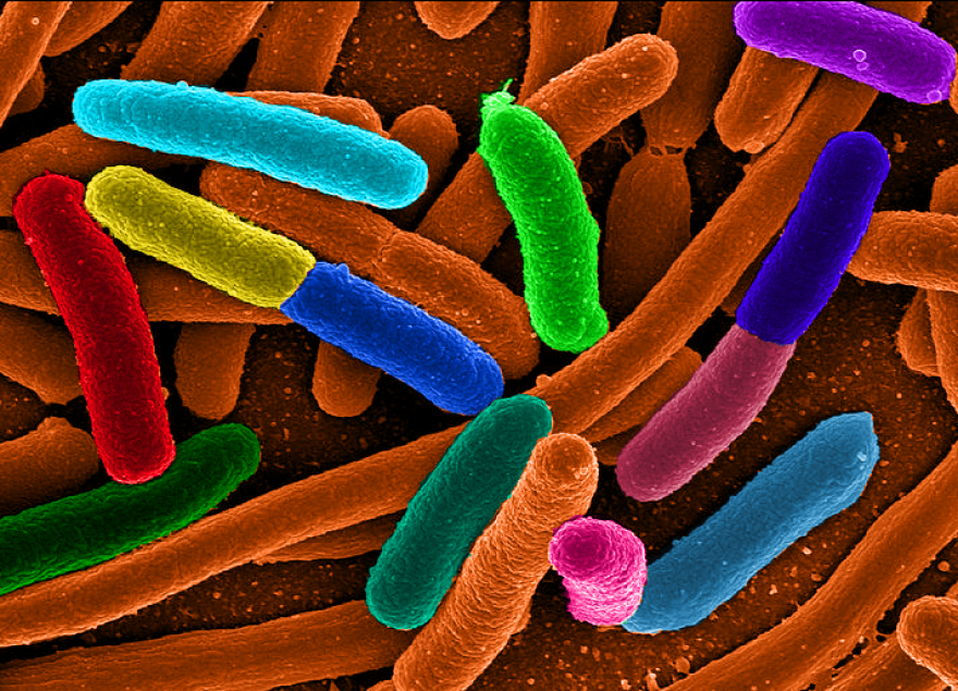 E. coli bacteria. At least 2,000 Americans are hospitalized and about 60 die as a result of E. coli infection each year.