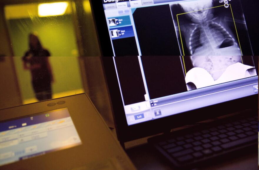 A radiology technician looks at a chest X-ray of a child suffering from flu symptoms at Upson Regional Medical Center in Thomaston, Georgia. (David Goldman/AP)