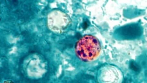 This photo shows four Cyclospora "oocysts" under a microscope. A Kansas woman is suing Taco Bell after she allegedly contracted the parasite from food there.