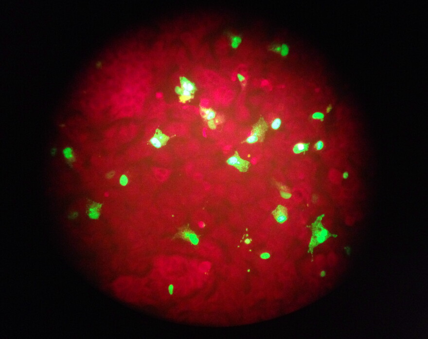 In this Feb. 26, 2015 photo taken through the eyepiece of a microscope, human cells infected with the flu virus glow green under light from a fluorescence microscope at a laboratory in Seattle. 