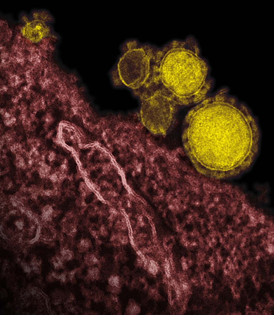 The Middle East respiratory syndrome virus (yellow) has infected at least 800 people globally and killed about a third of them.