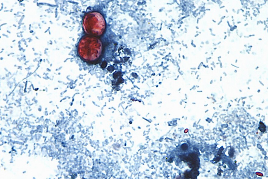 In the past, people have been infected with cycloporiasis by consuming fruits or vegetables that were exposed to contaminated irrigation water.