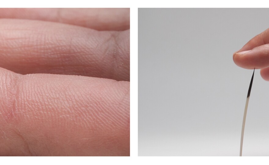 The quill tip in this finger has microscopic, backward-facing barbs that make the quill hard to remove. Bioengineers think the same sort of barbs could help keep dissolvable medical staples in place until a wound heals.