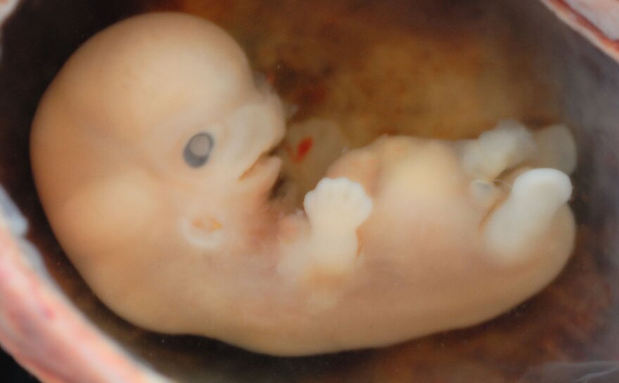 Human embryo