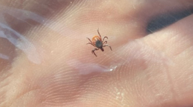 A minute tick is shown sandwiched between layers of packaging tape and held in a person's hand. The eight legs and brown body of the tick are clearly visible, as are the minute ridges of skin that cover the person's palm. the image is captioned "Deer tick sandwiched in tape".