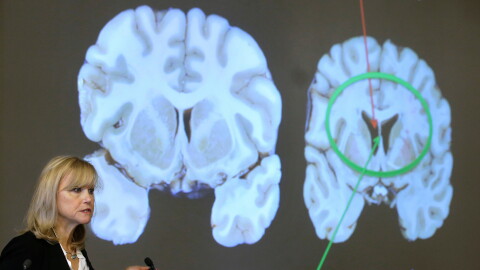 FILE - Ann McKee, director Boston University's center for research into the degenerative brain disease chronic traumatic encephalopathy, or CTE, addresses an audience on the school's campus Nov. 9, 2017 about the study of NFL football player Aaron Hernandez's brain, projected on a screen, behind right, in Boston.