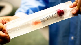 A vial used for conducting the COVID-19 test is held up at a drive-through mobile center outside Saint Francis Hospital and Medical Center. (Joe Amon/Connecticut Public/NENC)