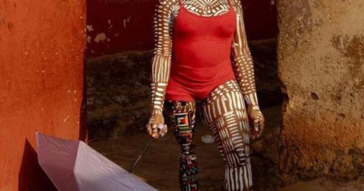 Ghanaian-American disability advocate struts the catwalk for awareness