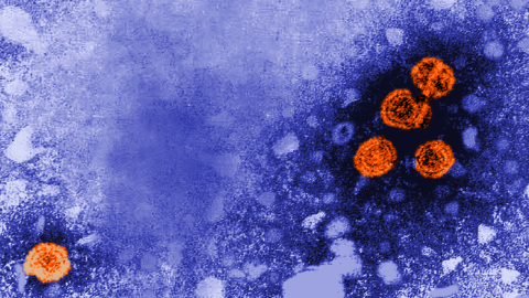 Hepatitis B virus particles, in orange, are seen in this microscopic image captured in 1981.