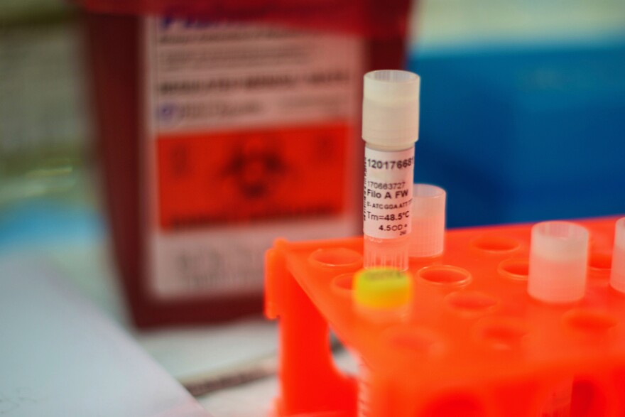 Some blood plasma samples collected from Ebola patients in West Africa also contained GB Virus-C.