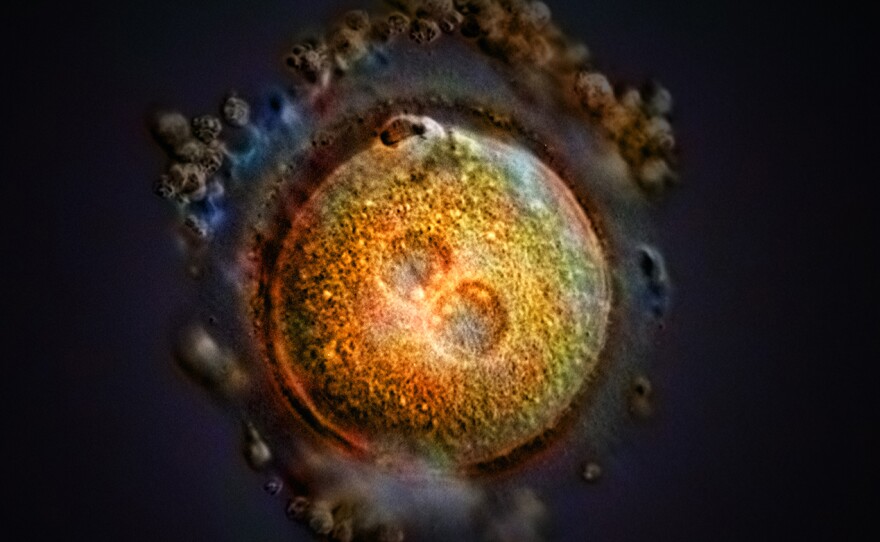 This computer-generated image shows the formation of a zygote after fertilization. Some Republican-led states, including Arkansas, Kentucky, Missouri, and Oklahoma, have passed laws declaring that life begins at fertilization, a contention that opens the door to a host of pregnancy-related litigation.
