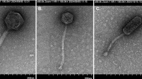 From left to right, newly discovered bacteriophages Revolver, Alamo and GiddyUp are seen under a transmission electron microscope.