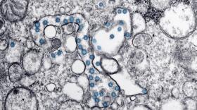 Transmission electron microscopic image of an isolate from the first U.S. case of COVID-19, formerly known as 2019-nCoV. The spherical viral particles, colorized blue, contain cross-sections through the viral genome, seen as black dots.