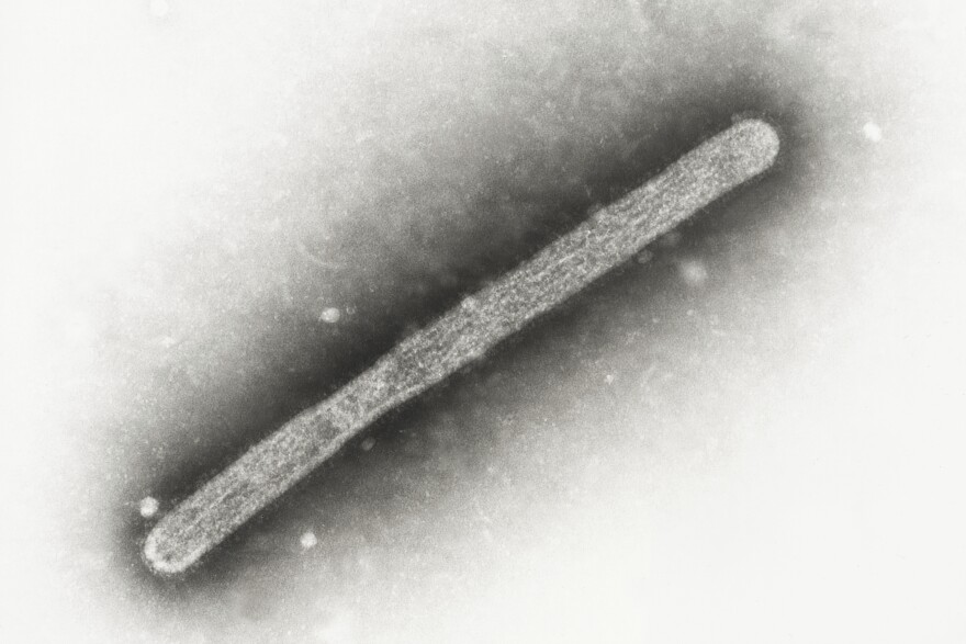 Esta imagen de microscopio electrónico de 2005 muestra un virión de influenza aviar A H5N1. El miércoles 22 de may de 2024, funcionarios de salud de Michigan dijeron que a un trabajador agrícola se le había diagnosticado gripe aviar, el segundo caso humano relacionado con un brote en vacas lecheras de EE. UU.