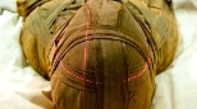 A team of doctors ran CT scans on 22 Mummies in Cairo last February.