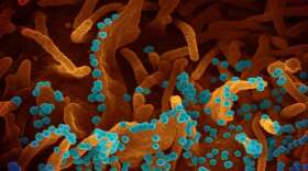 An electron microscope photograph from Elizabeth Fischer shows viral particles being released from a dying cell infected with the coronavirus. The dozens of small, blue spheres emerging from the surface of a kidney cell are the virus particles themselves. The images produced by the electron microscopes are black-and-white; a visual artist colorizes them. (Courtesy of Elizabeth Fischer)