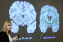 FILE - Ann McKee, director Boston University's center for research into the degenerative brain disease chronic traumatic encephalopathy, or CTE, addresses an audience on the school's campus Nov. 9, 2017 about the study of NFL football player Aaron Hernandez's brain, projected on a screen, behind right, in Boston.
