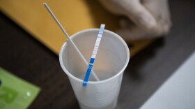 A fentanyl test strip is used to detect fentanyl in a drug sample. (Jesse Costa/WBUR)