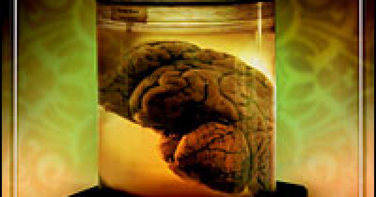 First Brain Thing The Long, Strange Journey of Einstein's Brain | WUWM 89.7 FM ...