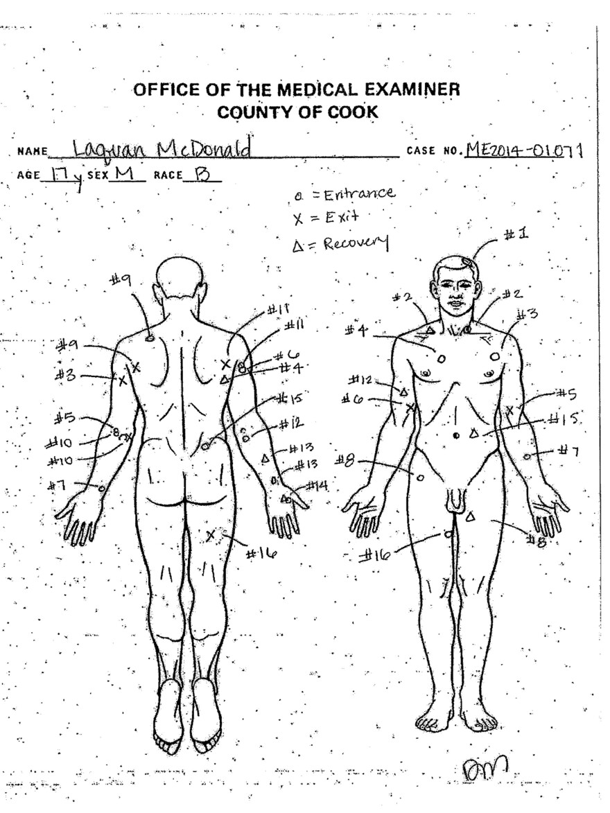 An autopsy diagram provided by the Cook County Medical Examiner's office shows the location of wounds on the body of Laquan McDonald.