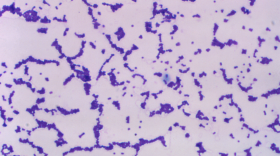 A view of the enterococcus bacteria under a high-powered microscope