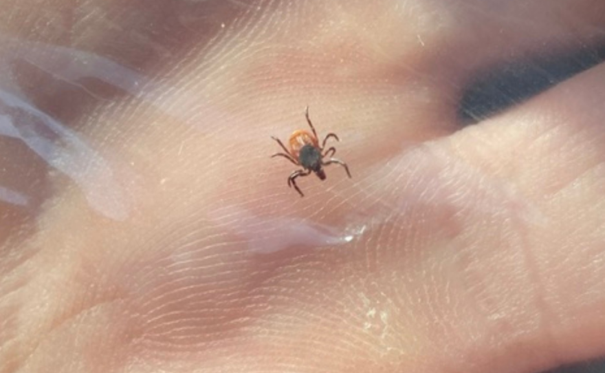 A minute tick is shown sandwiched between layers of packaging tape and held in a person's hand. The eight legs and brown body of the tick are clearly visible, as are the minute ridges of skin that cover the person's palm. the image is captioned "Deer tick sandwiched in tape".