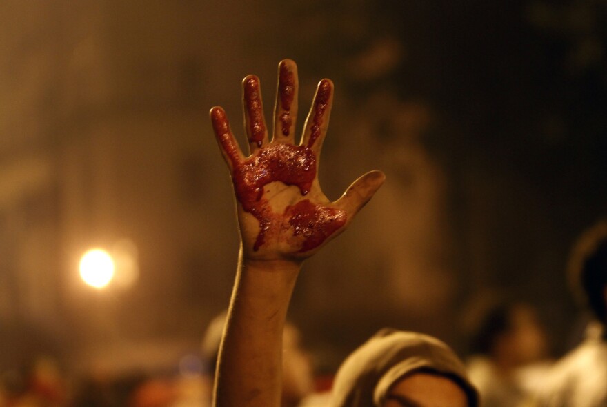 An Egyptian protester shows his palm stained with blood from a wounded demonstrator during clashes with security forces in Cairo on Friday.