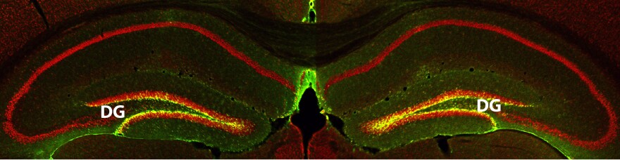 The yellow glow in this slice of hippocampus from a mouse brain represents the increased production of a memory-boosting protein called RbAp48.