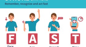 Stroke is ranked as the second leading cause of death worldwide, with an annual mortality rate of about 5.5 million people. 