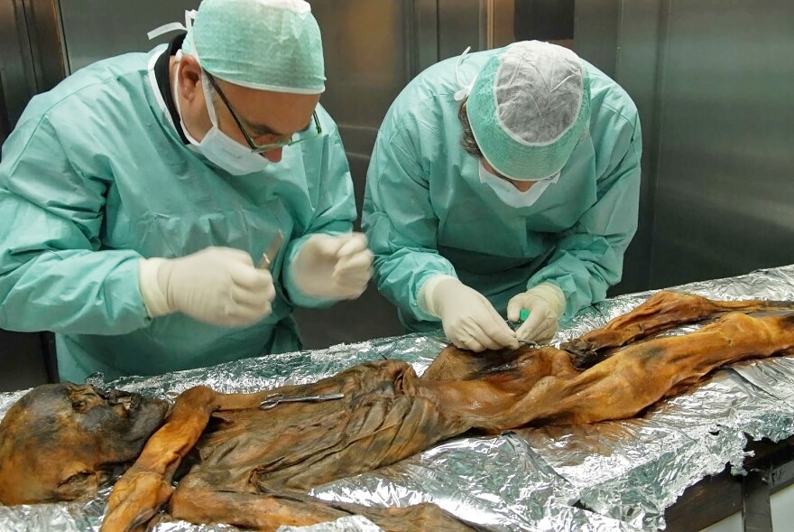 The stomach of Oetzi, who was mummified in ice, was home to bacteria that scientists were able to identify. The same species lives in the gut of many modern humans.