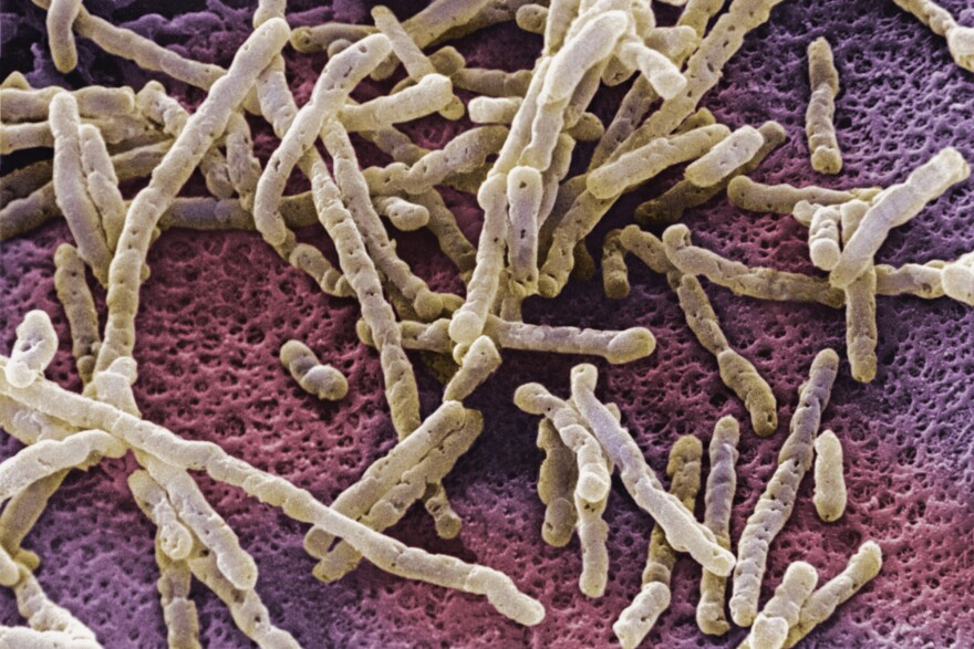 An overgrowth of <em>Clostridium difficile</em> bacteria can inflame the colon with a life-threatening infection.