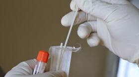 Ventura and Santa Barbara Counties are seeing skyrocketing COVID-19 case numbers coming out of the holidays.